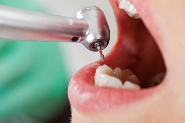 Best Root Canal Emergency Dentist  in Heathcote, NJ